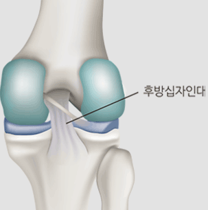 후방십자인대 모식도