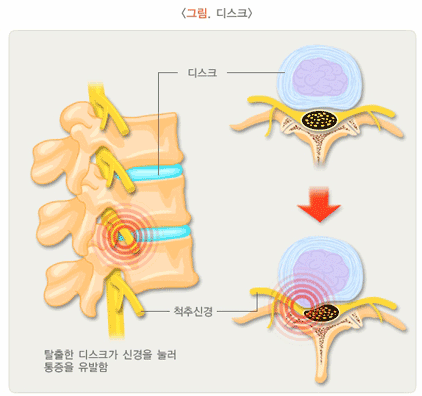 <그림. 디스크>