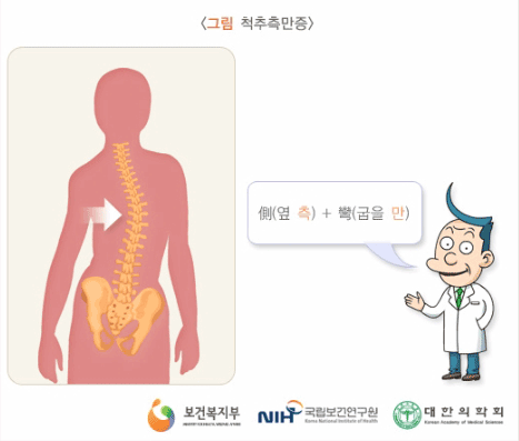 <그림. 척추측만증>