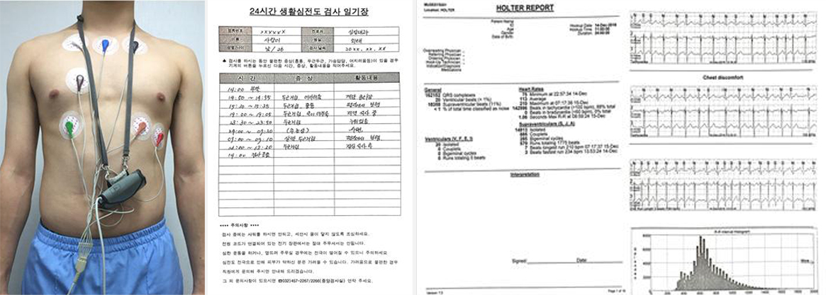 24시간 생활심전도 검사