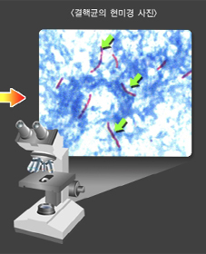 결핵군의 햔미경 사진