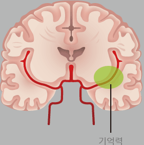 기억력