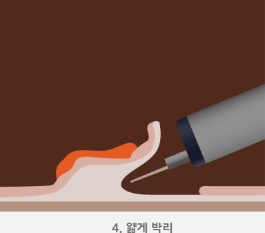 4.얇게 박리