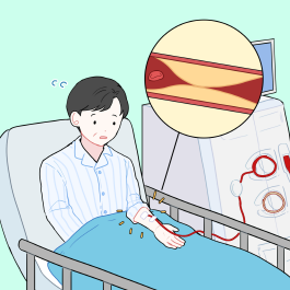 원활한 혈액 투석을 위한 동정맥루