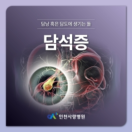 복강경 수술로 제거해야하는 담석증