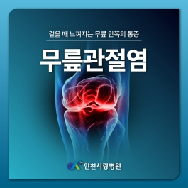 정도와 시기, 환자 상태와 나이에 맞게 치료방법을 정해야하는 무릎관절염