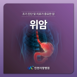 조기에 발견하면 생존율이 높은 위암