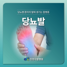 다리 절단까지 이어질 수 있는 당뇨발