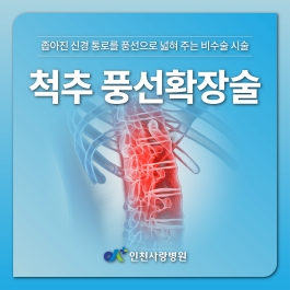 다리 저림이 걸음을 막기 전, 척추 풍선확장술